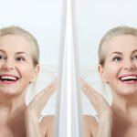 How to get rid of smile lines